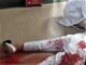 南宁市二院恶性杀医事件:一实习护士被割颈血流满地